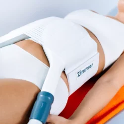 ztono pilvo preso formavimas