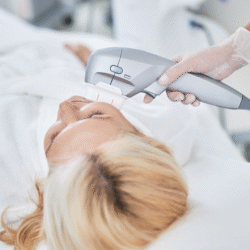 hifu veido patempimas