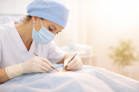 darinių šalinimas chirurginiu būdu